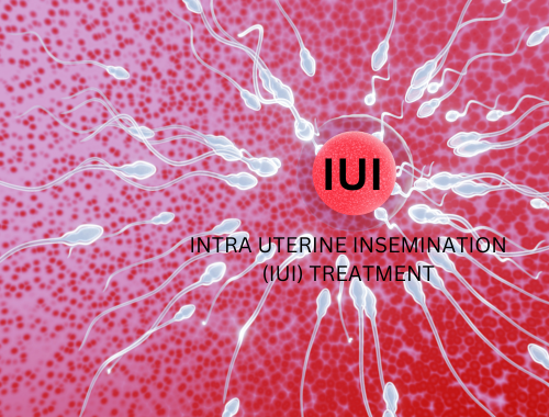 INTRA UTERINE INSEMINATION (IUI) TREATMENT