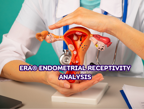 ERA® Endometrial Receptivity Analysis