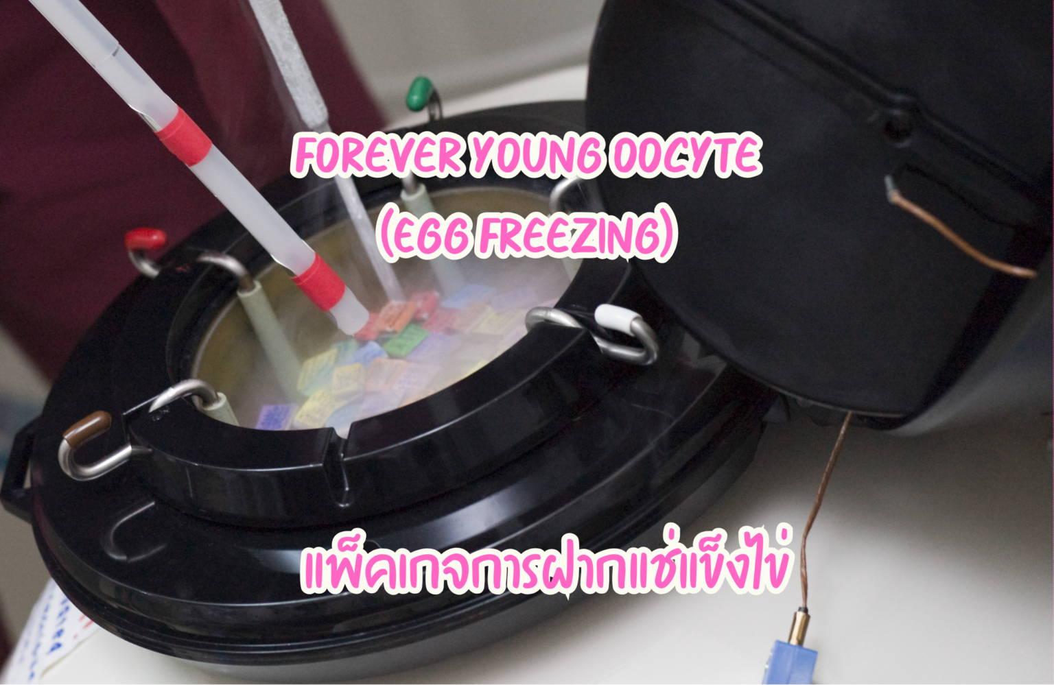 Forever Young Oocyte (Egg Freezing)
