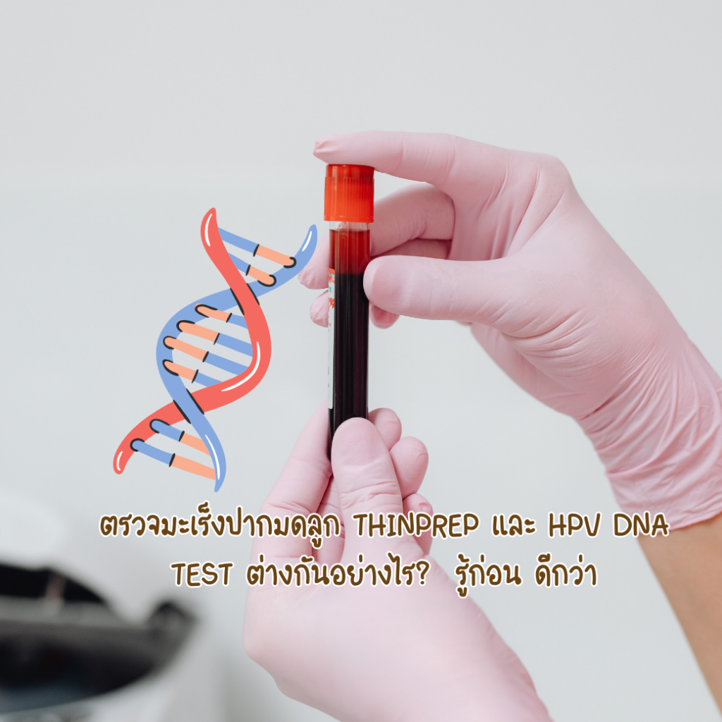 ตรวจมะเร็งปากมดลูก ThinPrep และ HPV DNA Test ต่างกันอย่างไร? ตรวจแบบไหนดีกว่ากัน